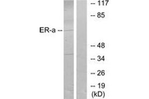 Western blot analysis of extracts from MCF7 cells, treated with Estradiol, using Estrogen Receptor-alpha (Ab-106) Antibody. (Estrogen Receptor alpha antibody  (AA 71-120))