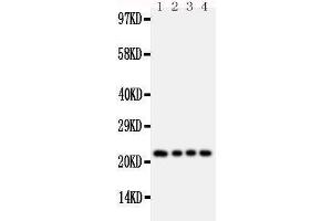Anti-FGF22 antibody, Western blotting Lane 1: Rat Ovary Tissue Lysate Lane 2: Rat Ovary Tissue Lysate Lane 3: Rat Testis Tissue Lysate Lane 4: Rat Testis Tissue Lysate (FGF22 antibody  (Middle Region))