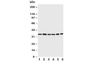 Western blot testing of Cdk4 antibody and Lane 1:  rat thymus