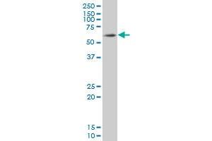 SOX9 monoclonal antibody (M02), clone 3C10 Western Blot analysis of SOX9 expression in HepG2 .