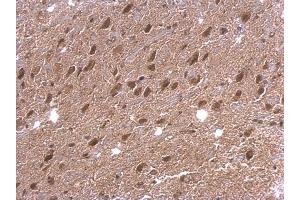 Immunohistochemistry (IHC) image for anti-Eukaryotic Translation Initiation Factor 4 gamma 2 (EIF4G2) (N-Term) antibody (ABIN2855137)