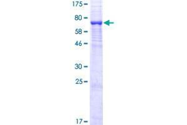 UGT3A1 Protein (AA 1-523) (GST tag)