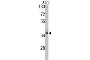 Western blot analysis of TALDO1 antibody (Center) in A375 cell line lysates (35ug/lane).
