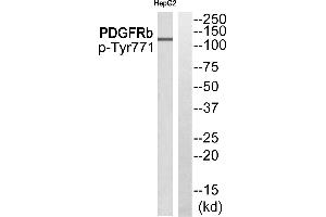 Western blot analysis of extracts from HepG2 cells, using PDGFRb (Phospho-Tyr771) antibody. (ARFGAP3 antibody  (Internal Region))