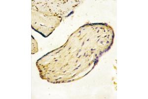 Formalin-fixed and paraffin-embedded human Placenta tissue reacted with CD73 (NT5E) Antibody (C-term) (ABIN388750 and ABIN2839011) , which was peroxidase-conjugated to the secondary antibody, followed by AEC staining. (CD73 antibody  (C-Term))