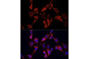 Immunofluorescence analysis of NIH/3T3 cells using DVL2 antibody (ABIN6130335, ABIN6139881, ABIN6139883 and ABIN6223455) at dilution of 1:100.