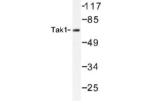 Image no. 1 for anti-Mitogen-Activated Protein Kinase Kinase Kinase 7 (MAP3K7) antibody (ABIN272124) (MAP3K7 antibody)