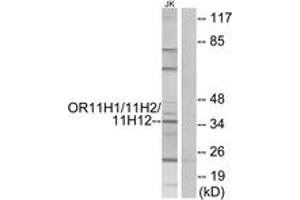 Western blot analysis of extracts from Jurkat cells, using OR11H1/11H2/11H12 Antibody. (Olfactory Receptor 11H1/11H2/11H12 (AA 277-326) antibody)
