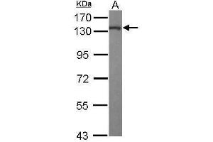 WB Image Sample (50 ug of whole cell lysate) A: Mouse brain 7. (KIF5A antibody  (C-Term))