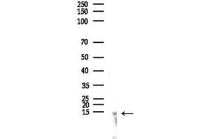 anti-Sjogren Syndrome Nuclear Autoantigen 1 (SSNA1) (N-Term) antibody