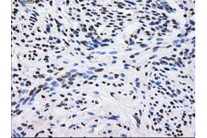 Immunohistochemical staining of paraffin-embedded Kidney tissue using anti-BTN3A2 mouse monoclonal antibody. (BTN3A2 antibody)