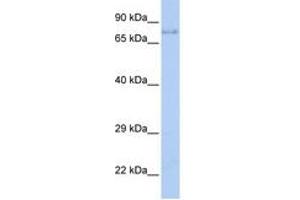 Image no. 1 for anti-Insulin-Like Growth Factor 1 Receptor (IGF1R) (C-Term) antibody (ABIN6744327)