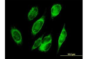 Immunofluorescence of purified MaxPab antibody to PRDX4 on HeLa cell.