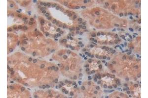 Detection of RSPO1 in Human Kidney Tissue using Polyclonal Antibody to R-Spondin 1 (RSPO1)