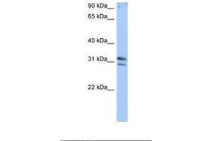 Image no. 1 for anti-RNA (Guanine-9-) Methyltransferase Domain Containing 3 (RG9MTD3) (AA 50-99) antibody (ABIN6739147) (RG9MTD3 antibody  (AA 50-99))