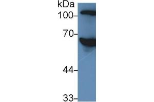 Rabbit Capture antibody from the kit in WB with Positive Control: Human serum. (SERPINC1 ELISA Kit)