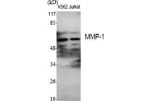 Western Blot analysis of various cells using MMP-1 Polyclonal Antibody diluted at 1:1000. (MMP1 antibody  (AA 380-460))