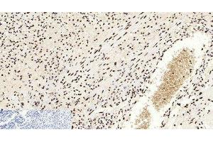 Immunohistochemistry of paraffin-embedded Human appendix tissue using Acetyl-Histone H3 (Lys9) Polyclonal Antibody at dilution of 1:200. (Histone 3 antibody  (acLys9))