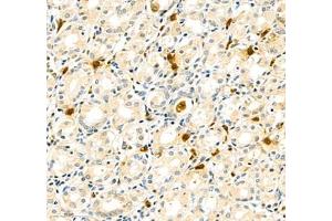 FCRL5 antibody