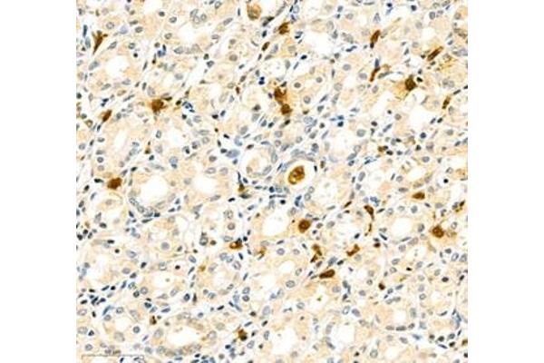 FCRL5 antibody
