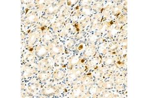 Immunohistochemistry of paraffin embedded human stomach using CD307 (ABIN7073931) at dilution of 1:1000 (300x lens) (FCRL5 antibody)