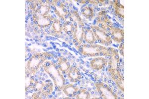 Immunohistochemistry of paraffin-embedded rat kidney using ALDH1A2 antibody (ABIN5975580) at dilution of 1/100 (40x lens). (ALDH1A2 antibody)