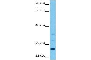 Host:  Rabbit  Target Name:  STEAP1  Sample Tissue:  Human Stomach Tumor  Antibody Dilution:  1ug/ml (STEAP1B antibody  (N-Term))