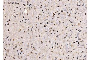 IHC analysis of KLF15 using anti-KLF15 antibody (ABIN7599269). (KLF15 antibody  (AA 1-323))