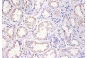 Immunohistochemistry of paraffin-embedded human kidney tissue using ABIN7155387 at dilution of 1:100 (H2AFX antibody  (AA 12-141))