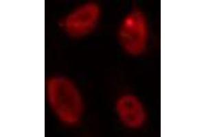 ABIN6274260 staining HepG2 cells by IF/ICC.