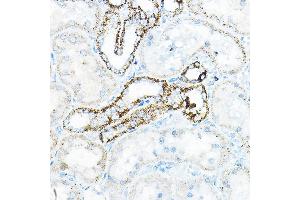 Immunohistochemistry of paraffin-embedded mouse kidney using BC Rabbit pAb (ABIN6131008, ABIN6137483, ABIN6137484 and ABIN6223295) at dilution of 1:100 (40x lens). (BCAT2 antibody  (AA 20-200))