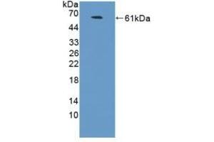 Detection of Recombinant NCAM2, Human using Polyclonal Antibody to Neural Cell Adhesion Molecule 2 (NCAM2) (NCAM2 antibody  (AA 21-297))