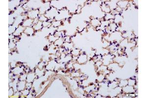 Formalin-fixed and paraffin embedded mouse lung labeled with Anti-SEZ6L Polyclonal Antibody, Unconjugated (ABIN762476) at 1:200 followed by conjugation to the secondary antibody and DAB staining (SEZ6L antibody  (AA 701-800))