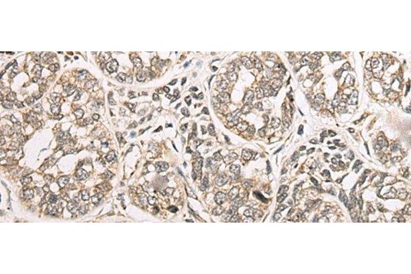 C1orf163 antibody