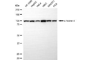 Western blotting analysis using alpha Actinin 4 antibody (ABIN7797475).