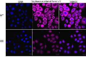 Immunocytochemical staining of HeLa cells using Diaphanous related formin 1 antibody (ABIN7798330), 1:1,000), Top panel: wild-type (WT), Bottom panal: Diaphanous related formin 1 shRNA knockdown (KD).