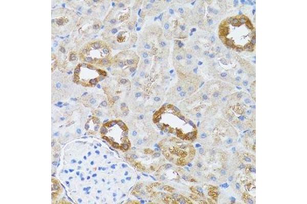 RNASEL antibody  (AA 472-741)