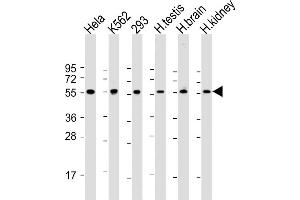 All lanes : Anti-PE Antibody (C-term) at 1:2000 dilution Lane 1: Hela whole cell lysate Lane 2: K562 whole cell lysate Lane 3: 293 whole cell lysate Lane 4: hun testis lysate Lane 5: hun brain lysate Lane 6: hun kidney lysate Lysates/proteins at 20 μg per lane.