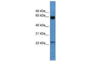 WB Suggested Anti-Baiap2 Antibody Titration:  0. (BAIAP2 antibody  (N-Term))