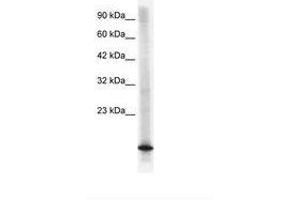 Image no. 1 for anti-Cyclin-Dependent Kinase Inhibitor 2B (p15, Inhibits CDK4) (CDKN2B) (C-Term) antibody (ABIN6735853) (CDKN2B antibody  (C-Term))
