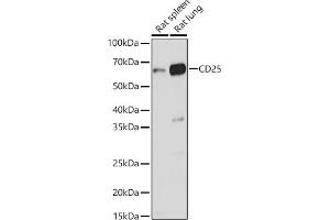Western blot analysis of extracts of various cell lines, using CD25 antibody (ABIN3017118, ABIN3017119, ABIN3017120 and ABIN6219963) at 1:1000 dilution. (CD25 antibody)