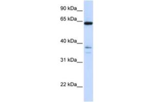 Western Blotting (WB) image for anti-Eukaryotic Translation Initiation Factor 2-alpha Kinase 2 (EIF2AK2) antibody (ABIN2463716) (EIF2AK2 antibody)