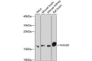 Western blot analysis of extracts of various cell lines using NAA20 Polyclonal Antibody at dilution of 1:1000.
