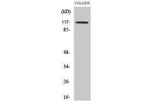 Western Blotting (WB) image for anti-Tripartite Motif Containing 24 (TRIM24) (C-Term) antibody (ABIN3187264) (TRIM24 antibody  (C-Term))