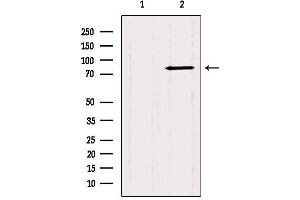 Western blot analysis of extracts from Mouse brain, using CTNNAL1 Antibody. (CTNNAL1 antibody  (Internal Region))