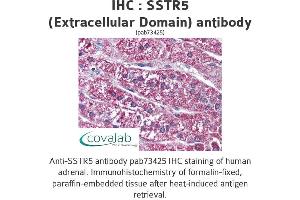 Image no. 1 for anti-Somatostatin Receptor 5 (SSTR5) (2nd Extracellular Domain) antibody (ABIN1739675) (SSTR5 antibody  (2nd Extracellular Domain))