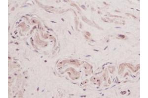 Image no. 1 for anti-Thymic Stromal Lymphopoietin (TSLP) antibody (ABIN465621) (Thymic Stromal Lymphopoietin antibody)
