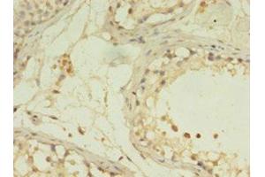 IHC analysis of paraffin-embedded human testis tissue, using G0S2 antibody (1/100 dilution).