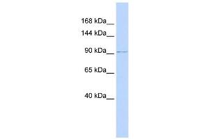 NDST3 antibody used at 1 ug/ml to detect target protein. (NDST3 antibody)