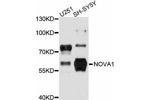Western blot analysis of extracts of various cell lines, using NOVA1 antibody (ABIN5998365) at 1:3000 dilution. (NOVA1 antibody)